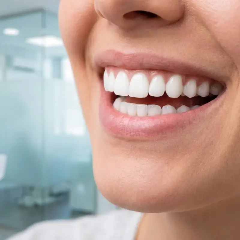 Odontología Estética